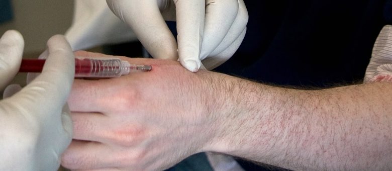 microchip
