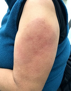 Coronaprik komt in rijksvaccinatieprogramma, ook aangeboden aan kleine kinderen 2 corona