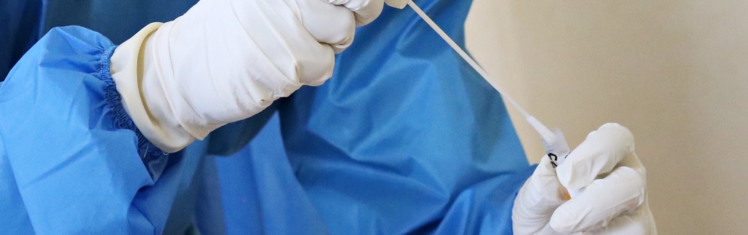 Zweedse RIVM: PCR-test volkomen ongeschikt om besmettingen aan te tonen