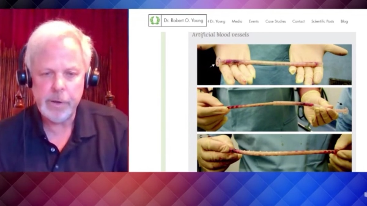 Dr. Robert Young laat zien: dit is wat er zoal uit lichamen van gevaccineerden wordt gehaald