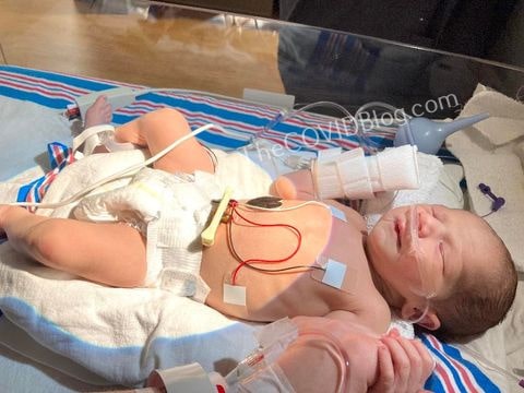 Tragisch: Baby Alex overlijdt aan 'enorme' bloedprop na bloedtransfusie 2 alex