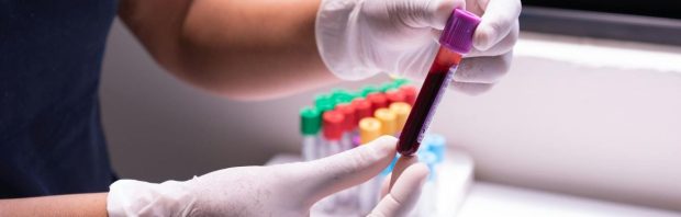 Bloedbank Sanquin doet bizarre uitspraken over bloedveiligheid na coronavaccinatie: een plakje cervelaat?!
