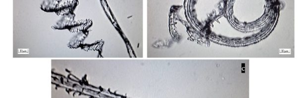 Kijk en huiver: deze bizarre nanostructuren hebben wetenschappers aangetroffen in de covidvaccins van Pfizer en Moderna