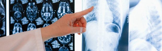 Aantal kankergevallen stijgt naar recordhoogte: bijna 1000 nieuwe diagnoses PER DAG