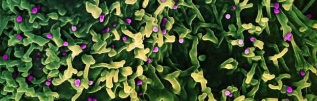 Doorlopen, niets te zien hier: bijsluiter mpoxvaccin vermeldt dat 1 op de 175 gevaccineerden hartproblemen krijgt