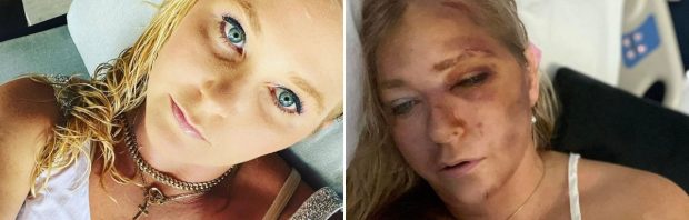 Epstein-slachtoffer Virginia ‘Ik ben niet suïcidaal’ Giuffre omgekomen door “zelfdoding”