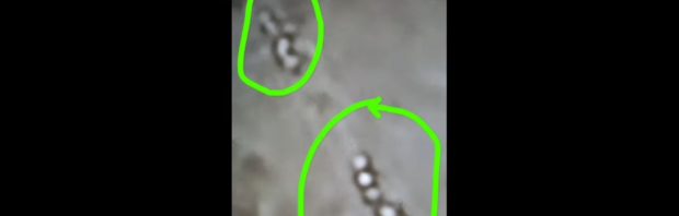 Arts laat zien wat hij heeft aangetroffen in het bloed van een 33-jarige ‘gevaccineerde’ patiënt