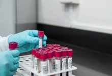 Amerikaanse biolabs in het buitenland: jarenlang verzwegen netwerk nu onthuld