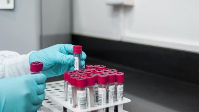 Amerikaanse biolabs in het buitenland: jarenlang verzwegen netwerk nu onthuld