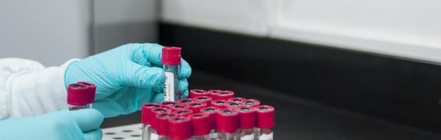 Amerikaanse biolabs in het buitenland: jarenlang verzwegen netwerk nu onthuld