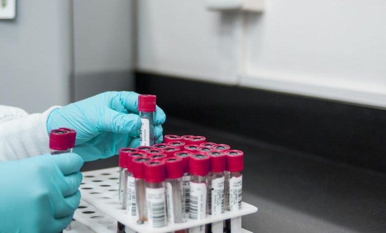 Amerikaanse biolabs in het buitenland: jarenlang verzwegen netwerk nu onthuld