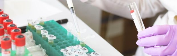 5 weken na gezamenlijke oefening: waarom duikt de pest nu op in Rusland?